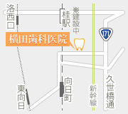 アクセスマップ